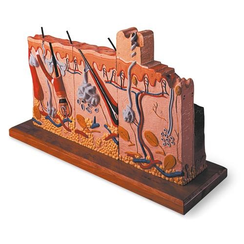 Hautmodell mit Verbrennungsstadien