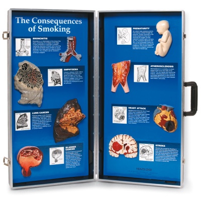 Die Folgen des Rauchens, 3D Schautafel