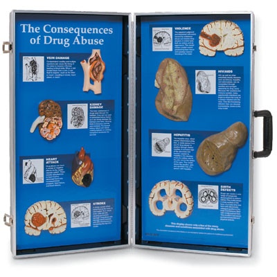 Die Folgen des Drogenmissbrauchs, 3D Schautafel