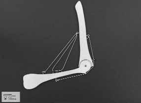 Funktionsmodell, Menschenarm, 50x30 cm
