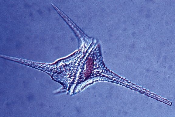 Mikropräparat - Ceratium, Panzergeißler aus dem Plankton Mikropräparat - Ceratium, Panzergeißler aus dem Plankton