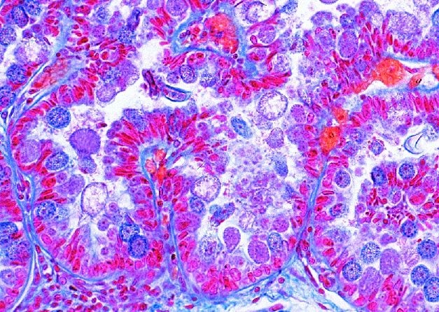 Mikropräparat - Eimeria stiedae, Erreger der Kokzidiose, Leber vom Kaninchen, quer Mikropräparat - Eimeria stiedae, Erreger der Kokzidiose, Leber vom Kaninchen, quer