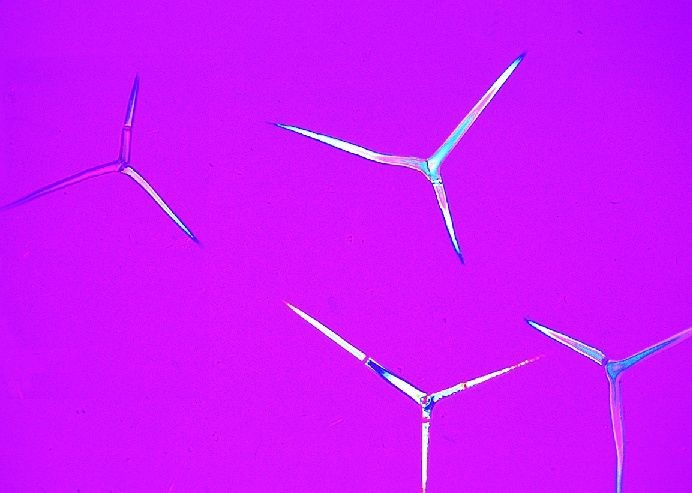 Mikropräparat - Spongilla, Süßwasserschwamm, Kieselkörperchen total Mikropräparat - Spongilla, Süßwasserschwamm, Kieselkörperchen total