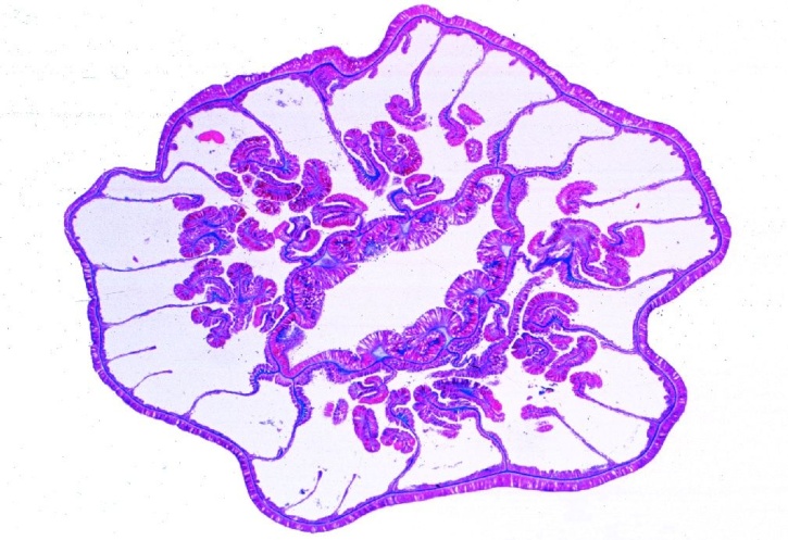 Mikropräparat - Actinia, Seerose, junges Tier quer Mikropräparat - Actinia, Seerose, junges Tier quer
