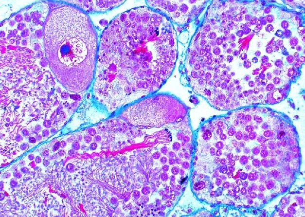 Mikropräparat - Helix, Weinbergschnecke, Zwitterdrüse quer Mikropräparat - Helix, Weinbergschnecke, Zwitterdrüse quer