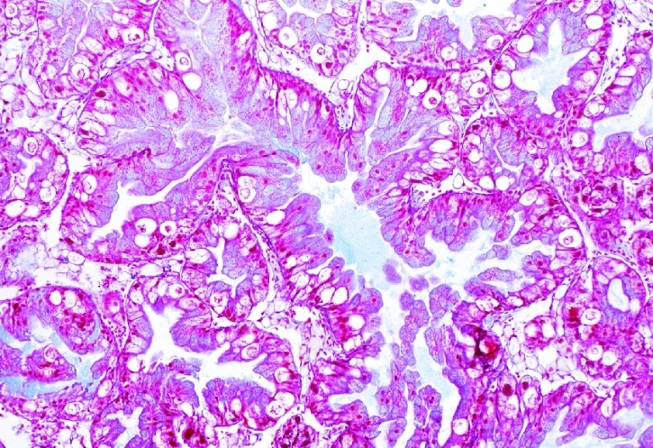Mikropräparat - Helix, Weinbergschnecke. Mitteldarmdrüse (Leber) quer Mikropräparat - Helix, Weinbergschnecke. Mitteldarmdrüse (Leber) quer