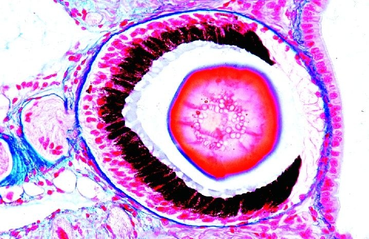 Mikropräparat - Helix, Weinbergschnecke, Augenfühler, längs. Linsenauge Mikropräparat - Helix, Weinbergschnecke, Augenfühler, längs. Linsenauge