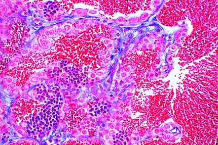 Mikropräparat - Cyprinus, Karpfen, Hoden quer, Samenfäden