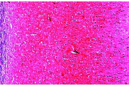 Mikropräparat - Großhirnrinde der Katze, quer, Pyramidenzellen