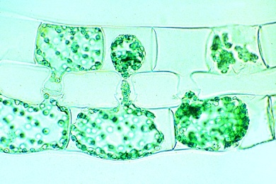 Mikropräparat - Spirogyra, Schraubenalge, Konjugationsstadien, Zygoten