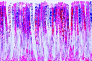 Mikropräparat - Morchella, Morchel, Fruchtkörper mit Asci, quer