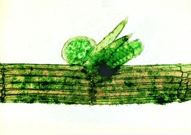 Mikropräparat -Chara, Armleuchteralge, Thallus mit Geschlechtsorganen