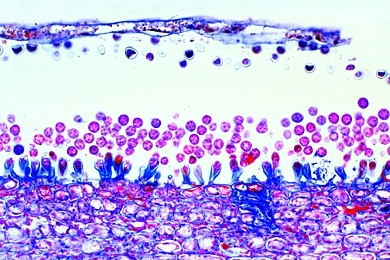Mikropräparat - Albugo candida, weißer Rost der Cruziferen, quer