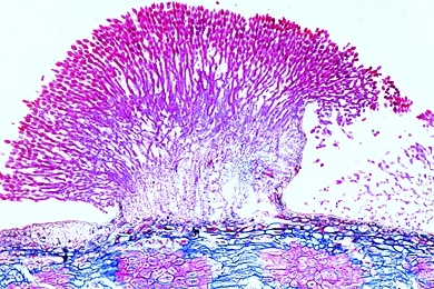 Mikropräparat - Sclerotinia (Monilia), Kernobstfäule, Konidienbildung