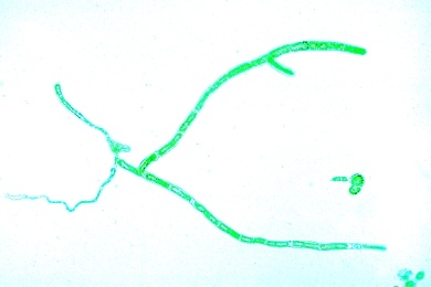 Mikropräparat - Laubmoos, Vorkeim (Protonema), total