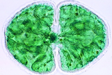 Mikropräparat - Cosmarium, Zieralge
