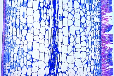 Mikropräparat - Laminaria saccharina, Zuckertang, Thallus, quer, Unilokuläre, Sporangien