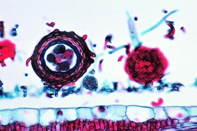 Mikropräparat - Erysiphe pannosa, Rosenmehltau. Blatt mit Konidien, quer