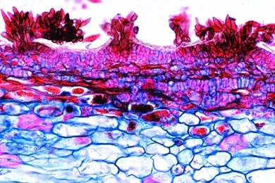Mikropräparat - Venturia pirinum (Fusicladium), Birnenschorf, Konidien quer