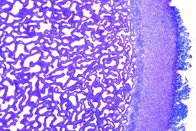 Mikropräparat - Scleroderma vulgare, Kartoffelbovist, Fruchtkörper quer
