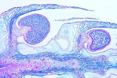 Mikropräparat - Lycopodium, Bärlapp, Sporophyllstand mit Sporen, längs