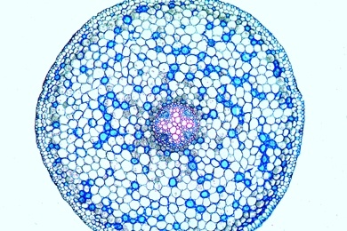 Mikropräparat - Ranunculus, Hahnenfuß, Wurzel quer, Dikotyle Wurzel