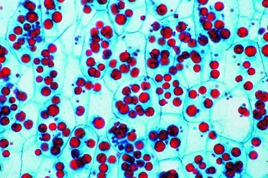 Mikropräparat - Aleuronkörner, Endosperm von Ricinus, quer