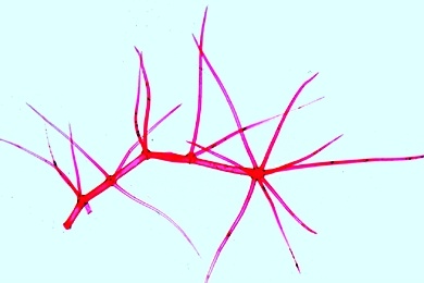 Mikropräparat - Verzweigte Blatthaare von Verbascum, Königskerze, total