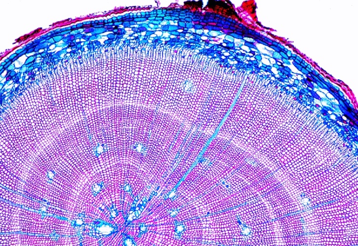 Mikropräparat - Pinus, Kiefer, ältere verholzte Wurzel, quer