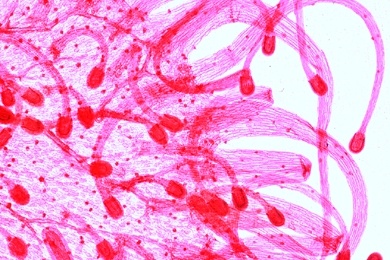 Mikropräparat - Drosera, Sonnentau, Blatt mit Drüsenhaaren