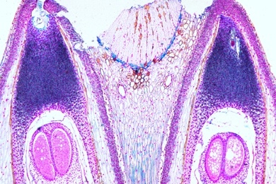 Mikropräparat - Pinus, Kiefer, Samenanlagen mit Archegonien, längs