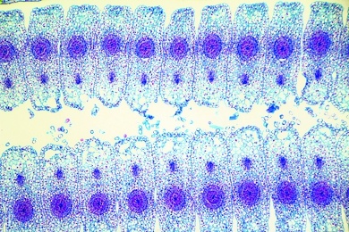 Mikropräparat - Tulipa, Tulpe, Fruchtknoten mit Samenanlagen, längs