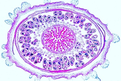 Mikropräparat - Papaver, Mohn, Blüte quer, Blütendiagramm