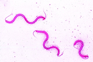 Mikropräparat - Spirillum volutans, Faulwasser-Organismen, Große Spirillen