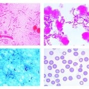 Mikropräparate - Bakterien als Krankheits- und Seuchenerreger, 25 Präparate