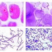 Mikropräparate - Bakterien, Große Serie, 50 Präparate (Neue Ausführung), Mit ausführlichem Begleittext