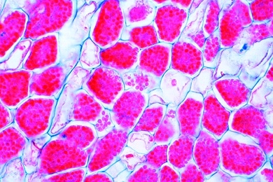 Mikropräparat - Actinomyces alni, Wurzelknöllchen mit Mykorrhiza der Erle, Schnitt