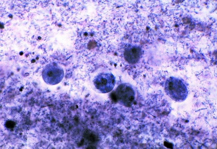 Mikropräparat - Entamoeba histolytica, Amöbenruhr, Ausstrich oder Schnitt