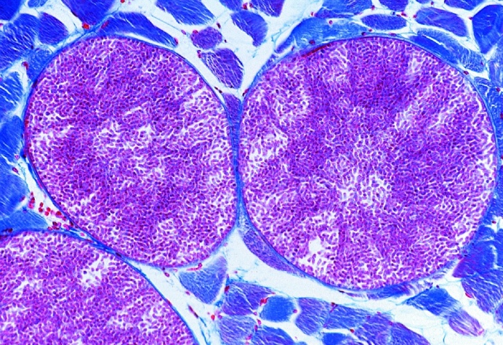 Mikropräparat - Sarcocystis sp., Schnitt durch infiziertes Muskelgewebe. Mieschersche Schläuche
