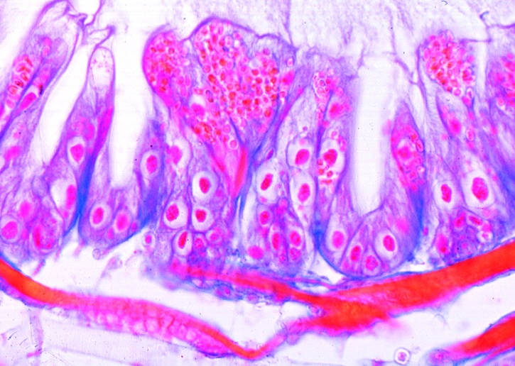 Mikropräparat - Nosema apis, Bienenruhr, Darm einer erkrankten Biene quer