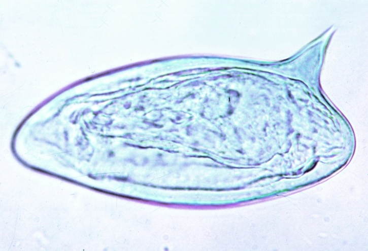 Mikropräparat - Schistosoma mansoni, Eier im Stuhl