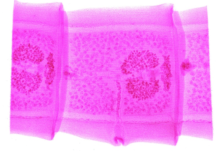 Mikropräparat - Taenia pisiformis, Hundebandwurm, reife Proglottiden (Glieder) total