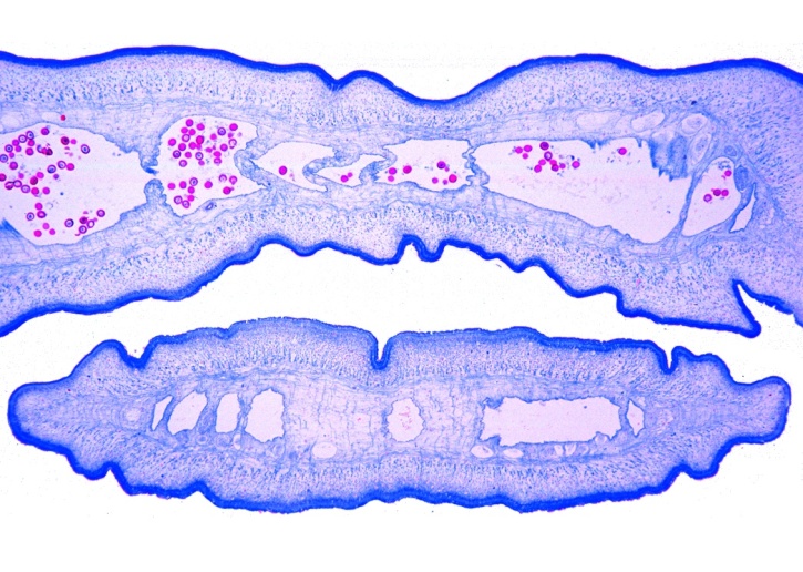 Mikropräparat - Taenia saginata, Rinderbandwurm, Proglottiden in verschiedenen Reifestadien, quer