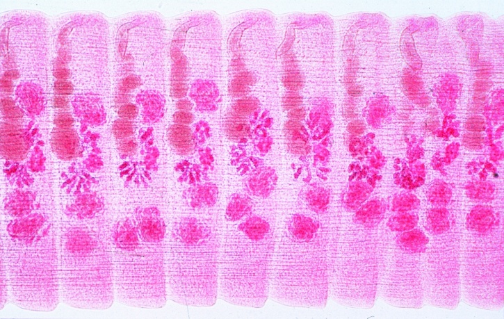 Mikropräparat - Hymenolepis sp., Zwergbandwurm, Proglottiden total