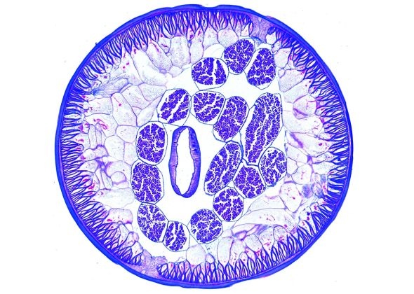 Mikropräparat - Ascaris lumbricoides, Spulwurm, Querschnitt durch die Geschlechtsregion vom Männchen