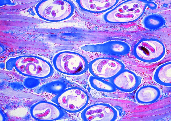 Mikropräparat - Trichinella spiralis, Trichine, eingekapselte Larven im Muskel