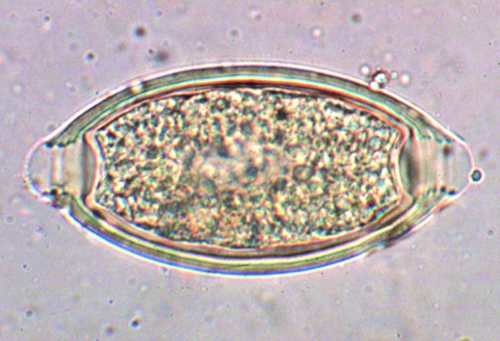 Mikropräparat - Trichuris trichiura, Peitschenwurm, Eier