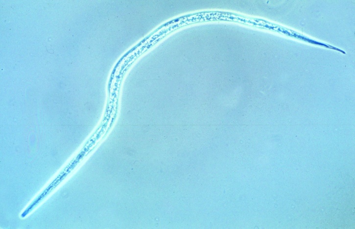 Mikropräparat - byloides stercoralis, Zwergfadenwurm, Larven total