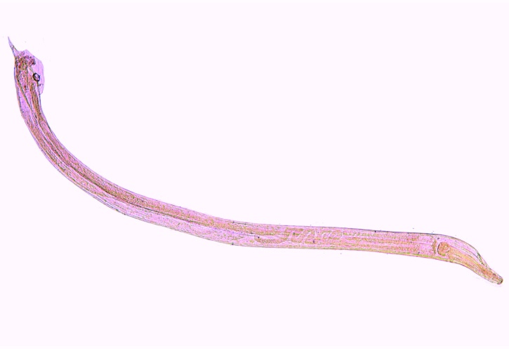 Mikropräparat - Heterakis spumosa, Parasit in Nagetieren, total