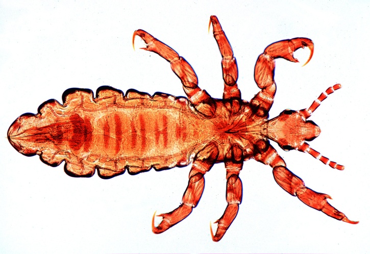 Mikropräparat - Pediculus humanus, Kopf- oder Kleiderlaus